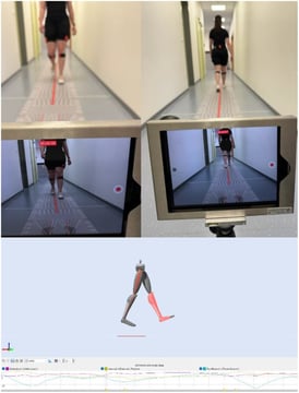 Kinematic effects of sensorimotor foot orthoses on the gait of patients with patellofemoral pain - a randomized controlled trial